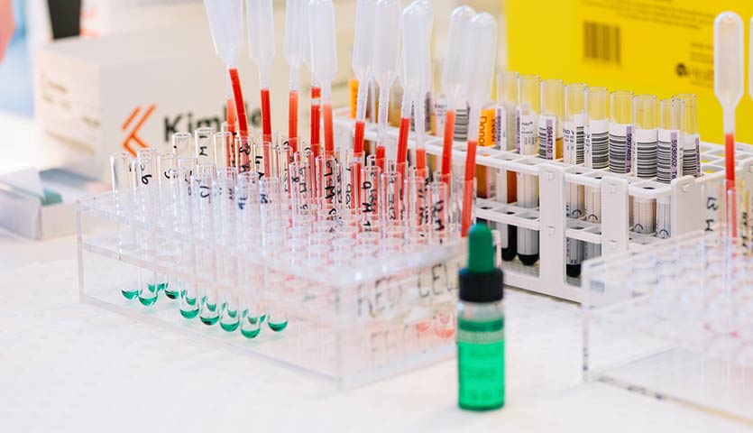 a group of blood samples and testing equipment