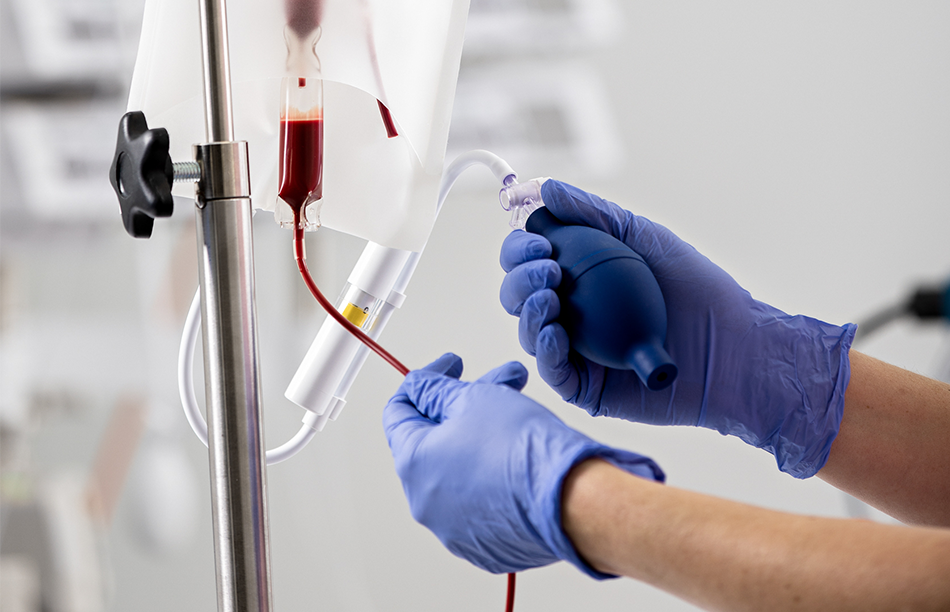 image of blood transfusion set up with gloved hands holding tube